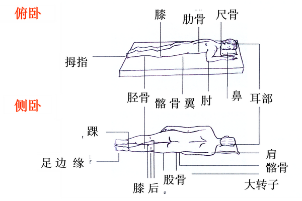 形成原因 压力因素  1)垂直压力(2)摩擦力(3)剪切力 皮肤受潮湿或