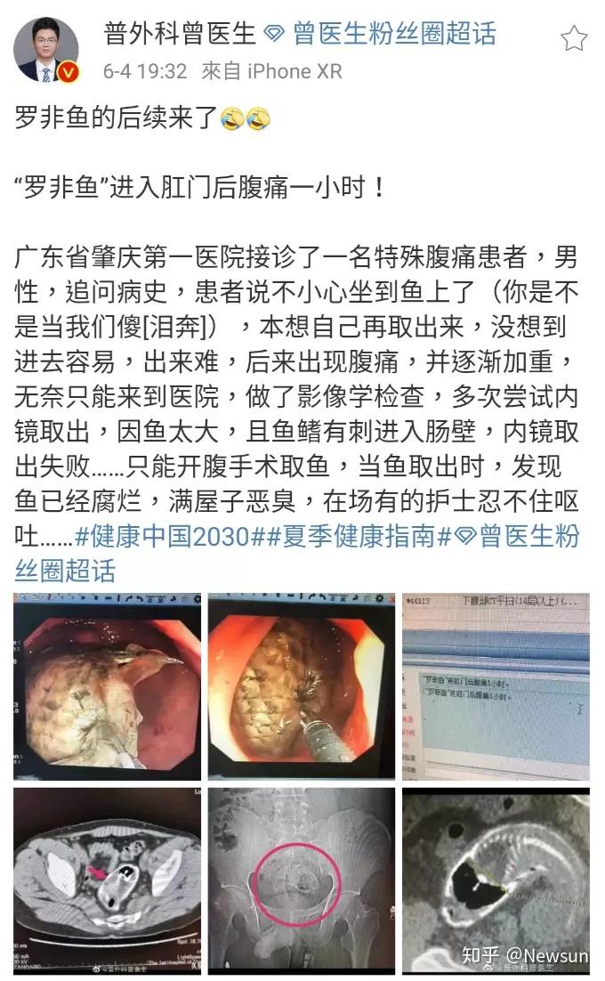 小两口作死指南让医生都后怕的奇啪案例你们就不能轻点吗