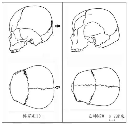 山东广饶傅家大汶口文化遗址出土的变形头骨对比图