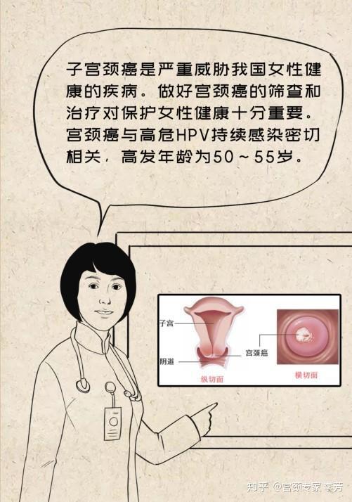 女性杀手宫颈癌到底该如何防治