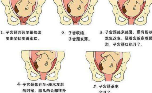 自然分娩