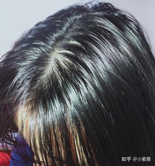 头发再油能油的过我吗?你们敢信这是我刚洗完的头发?