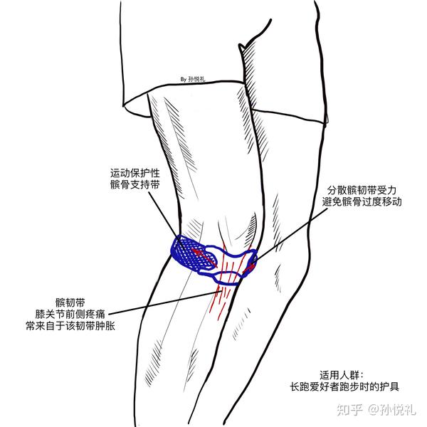 髌骨带示意图