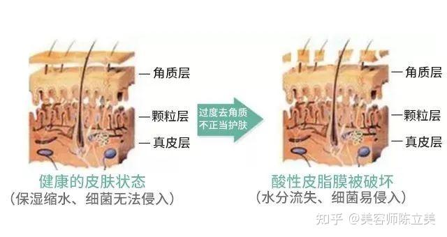 因为紫外线不当会损伤角质层,还可能穿透受损角质,对皮肤带来更深的