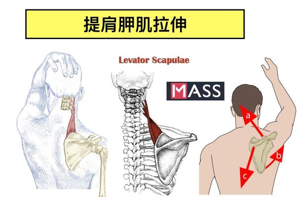 加强肩胛骨稳定的训练