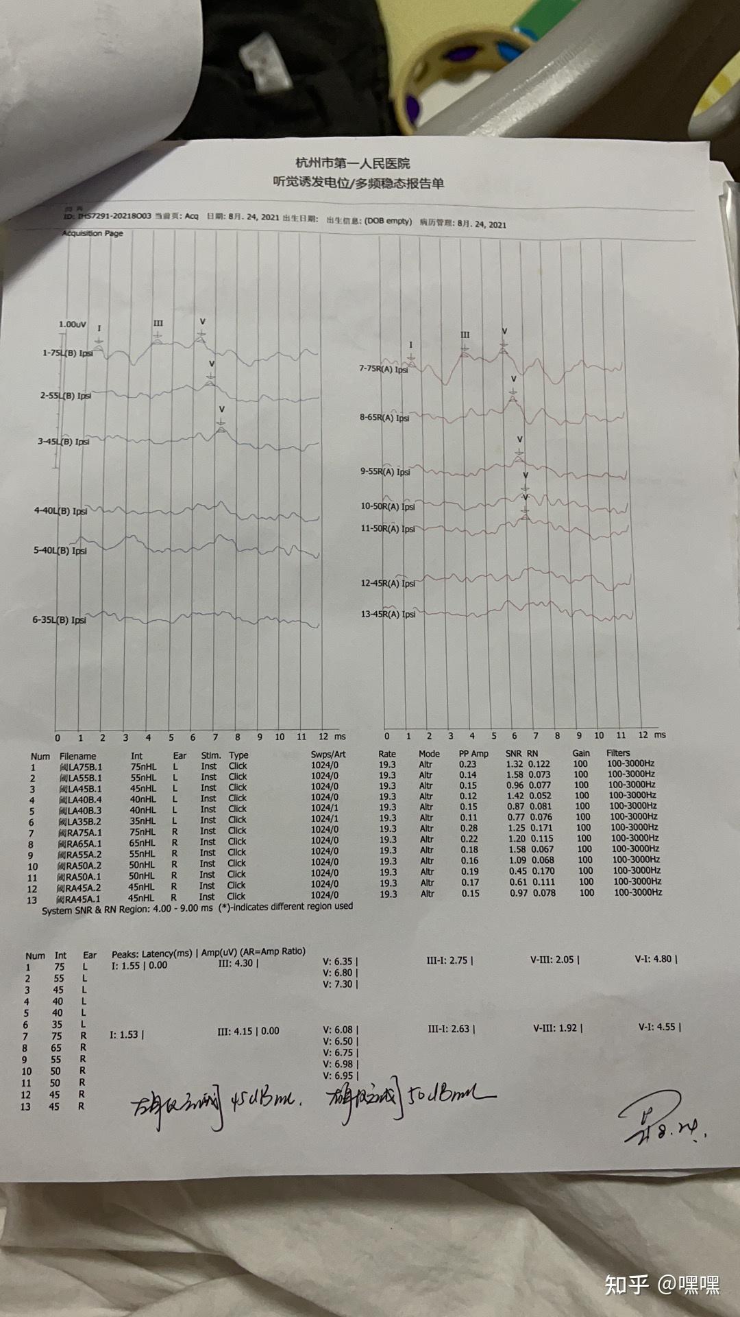 宝宝出生耳声发射通过,黄疸18入院,入院前在家里耳朵听的见,打喷嚏都