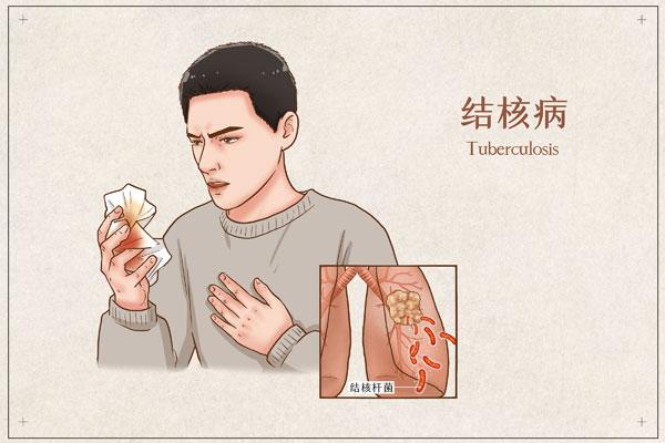 肺结核分为哪些类型有哪些检查