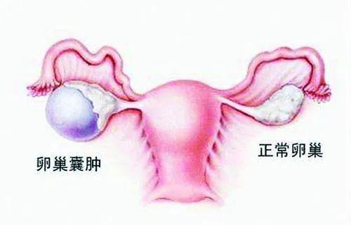 妇科主任提醒:如果女人有这4种"痛",解决妇科问题刻不