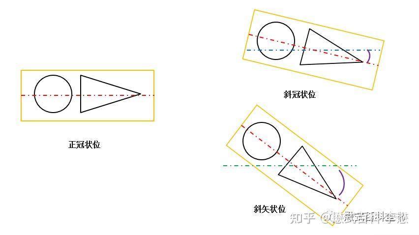 当在横轴位图像上,角度过大,可能方位就是发生变化