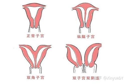 什么样的子宫内膜是好内膜?
