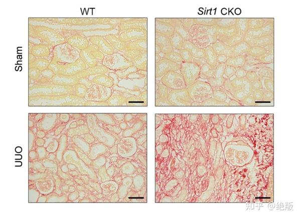 huang和同事通过基因消除了小鼠sirt1的功能并诱发了肾脏瘢痕形成