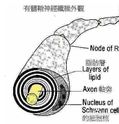 脑白质脱髓鞘的早中晚期