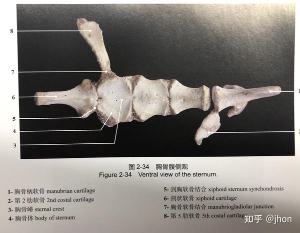 正中胸骨切开术(median sternotomy)