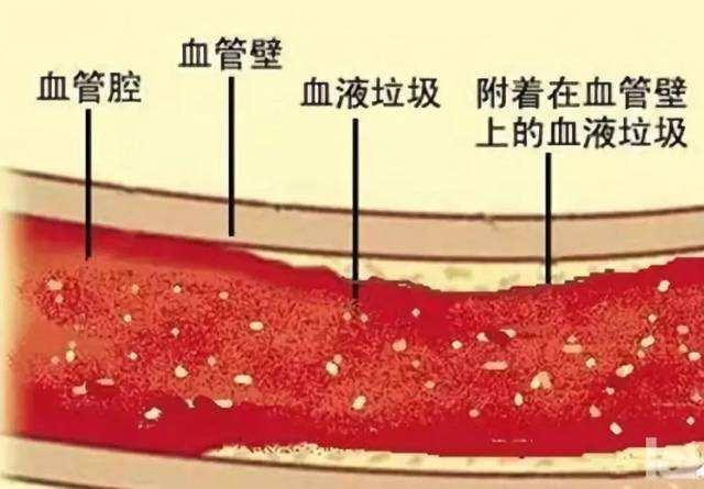 怎么解决酸中毒改善高血压动脉硬化心脏病等慢性疾病