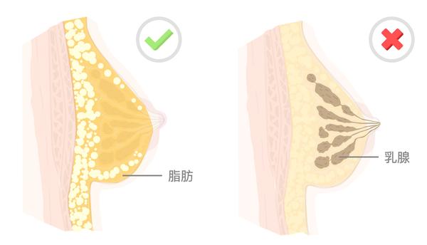 关于乳房你不得不知道的100个基本常识2