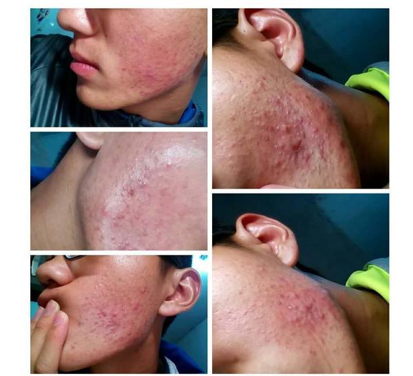 一个油腻腻的痘痘男生,如何在大学之前逆袭的?