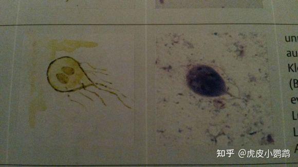 显微镜下的贾第鞭毛虫左侧是手绘示意图