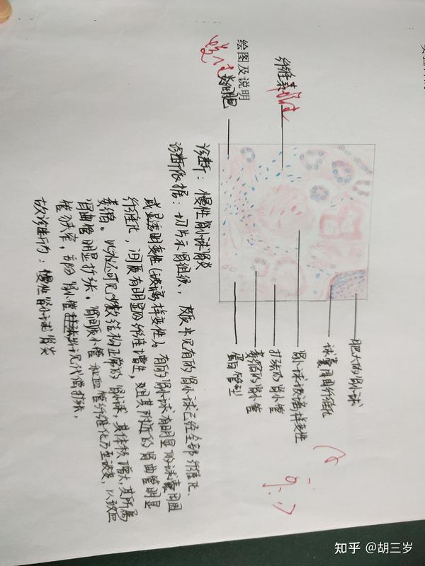 病理学切片红蓝绘图