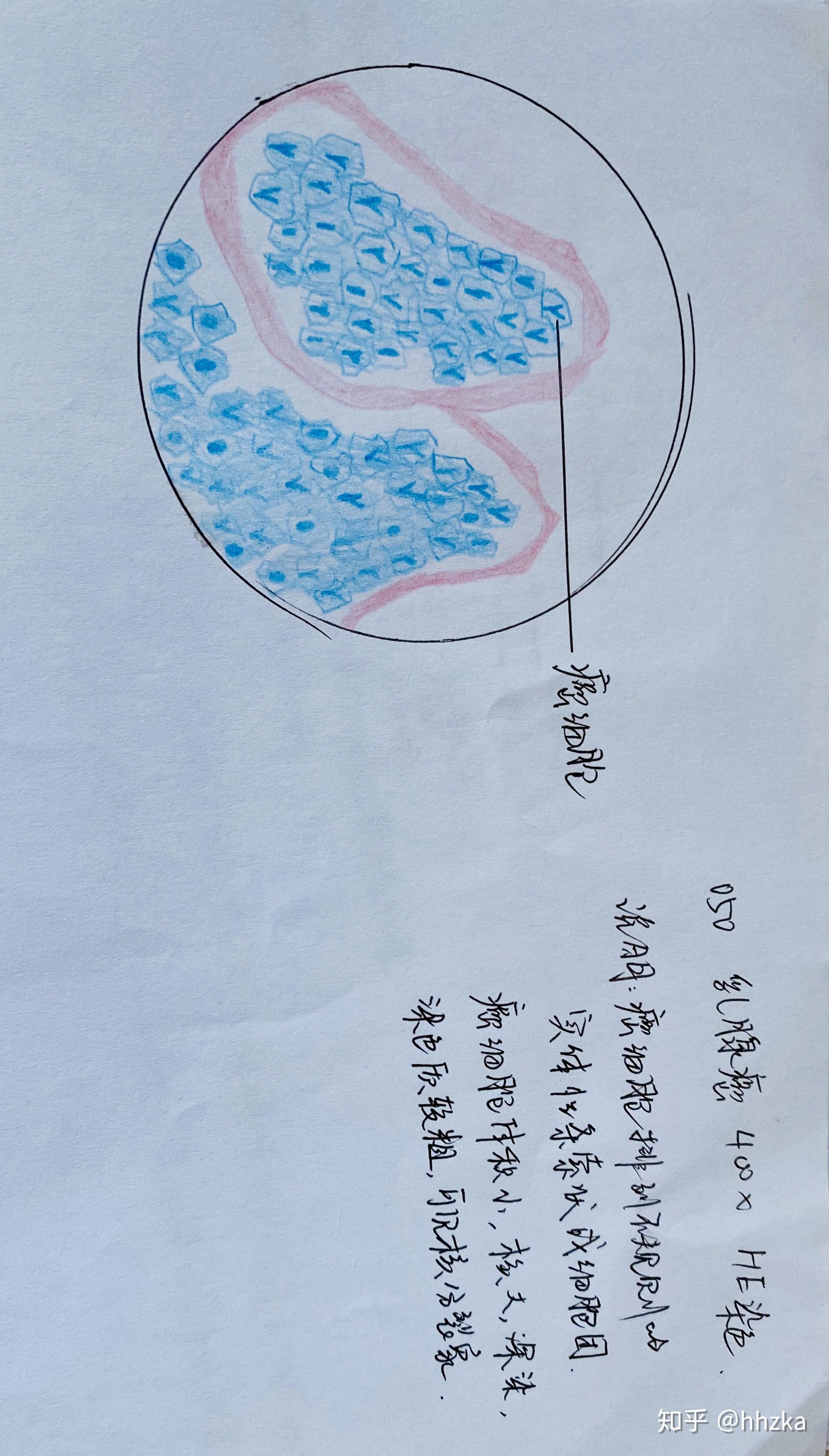 病理学切片红蓝铅手绘图