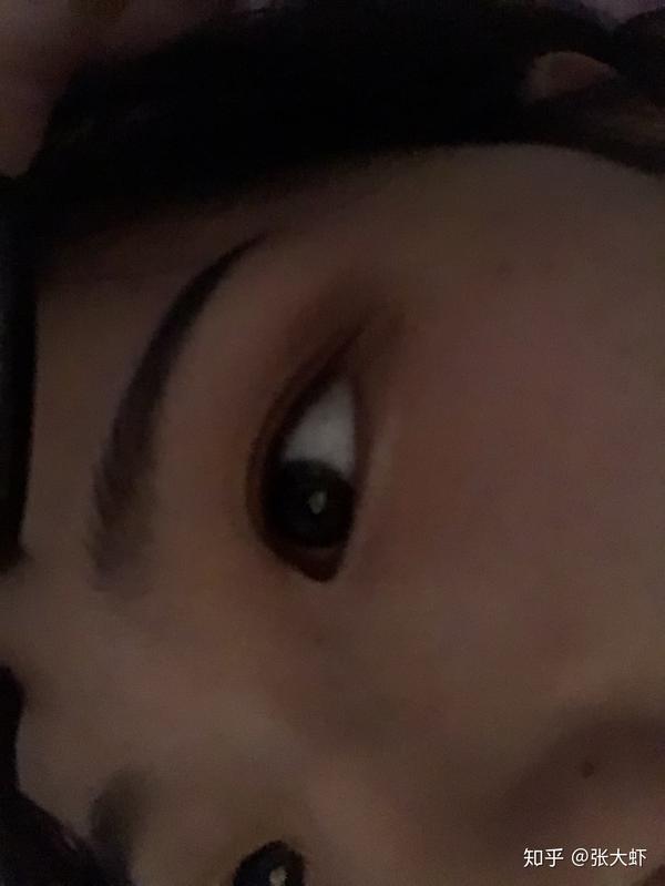 肉泡眼贴什么双眼皮贴?