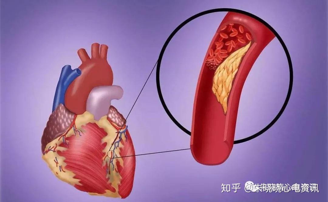 心健康丨左胸隐隐作痛是什么病该做什么检查