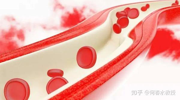 血管疾病-血管炎