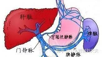 肝硬化门静脉高压患者反复消化道大出血怎么办?——tips术