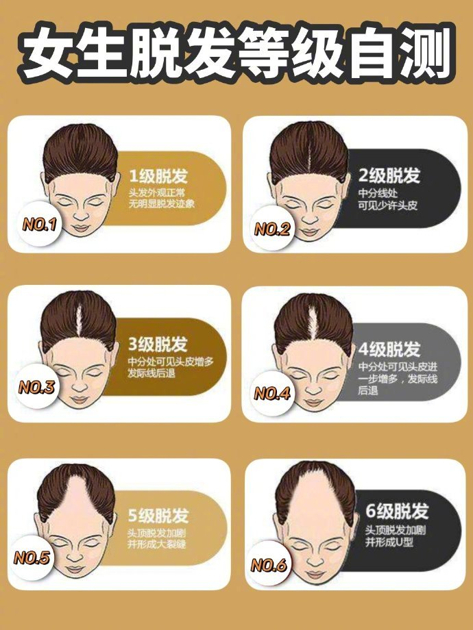 帮我看下我有没有脱发问题?
