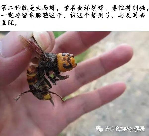 被蜜蜂蛰了,这种情况严重吗,怎么处理,需不需要去医院
