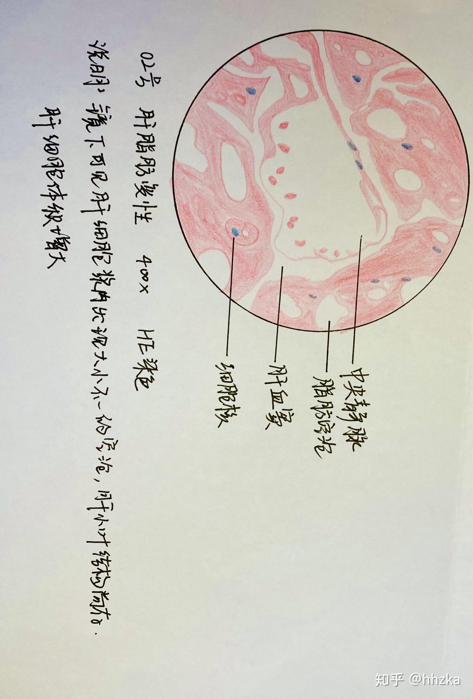 病理学切片红蓝铅手绘图