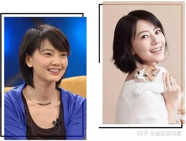 明星的亲身经历告诉你怎么变美!