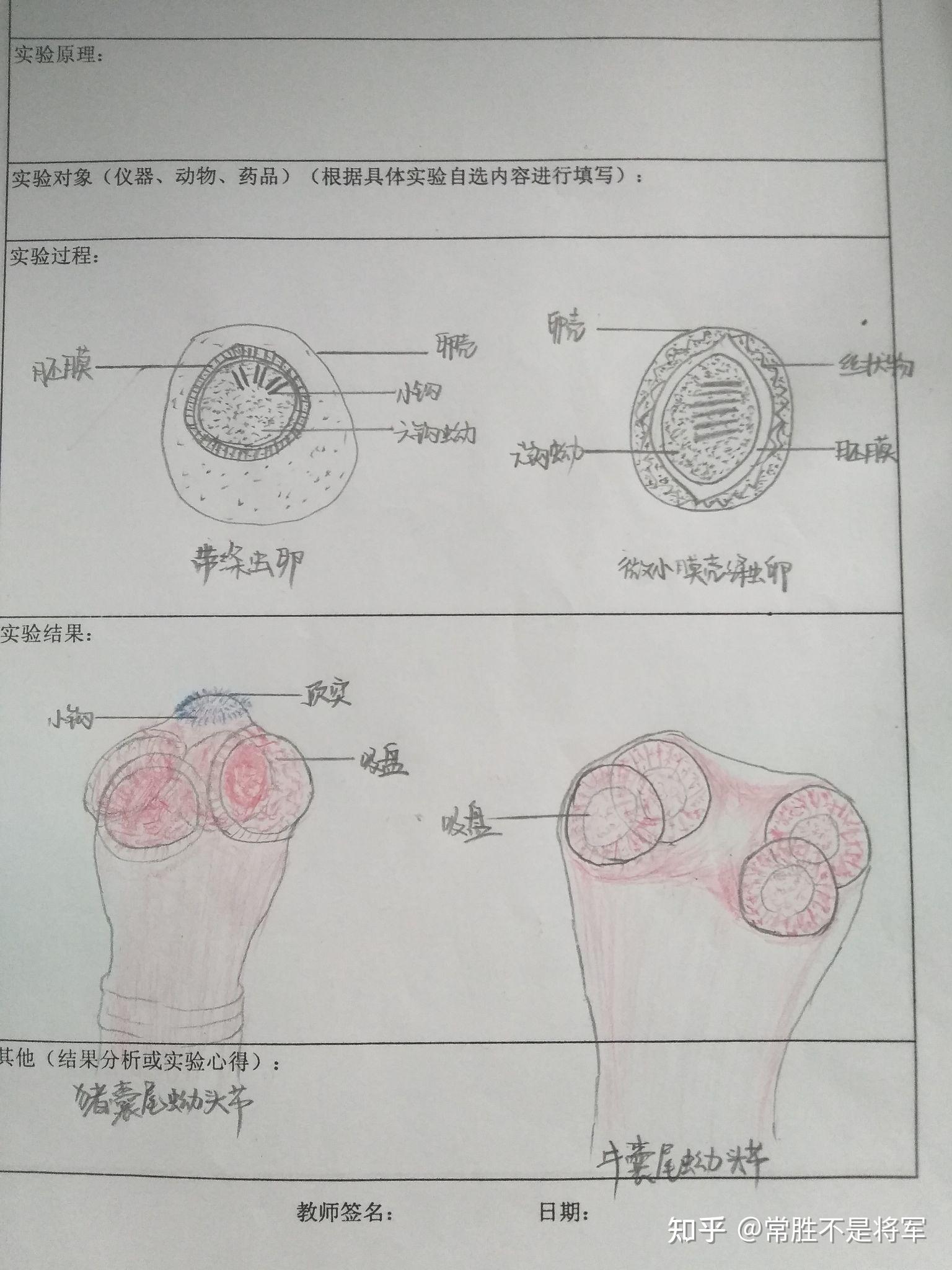 分享一波寄生虫标本手绘