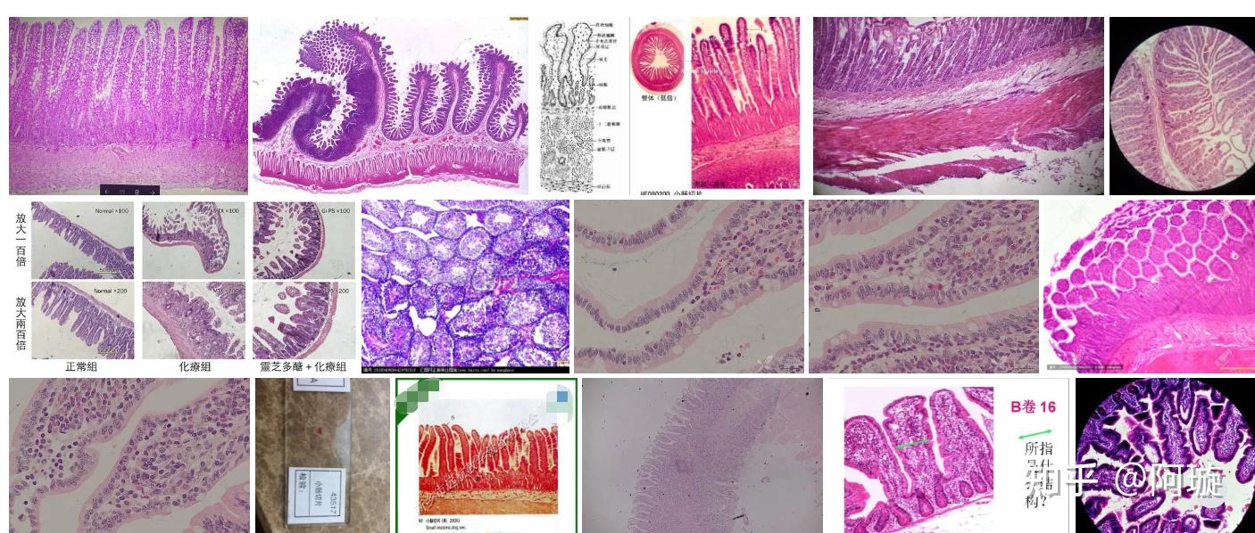 结肠和小肠在显微镜下怎么区分?