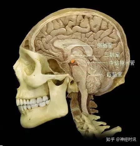 矢状位 三脑室通过双侧室间孔与双侧脑室相连,通过中脑导水管与四