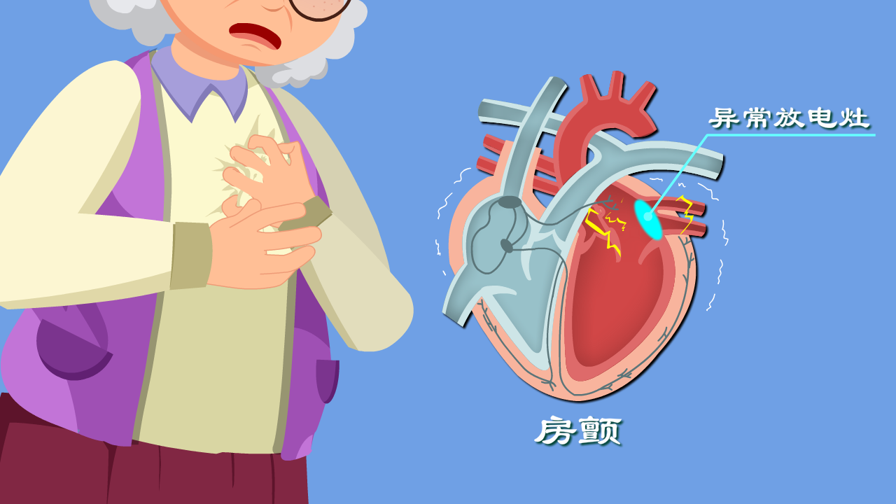 心律失常咋回事心慌胸闷背后真相是啥房颤发病机制动漫版