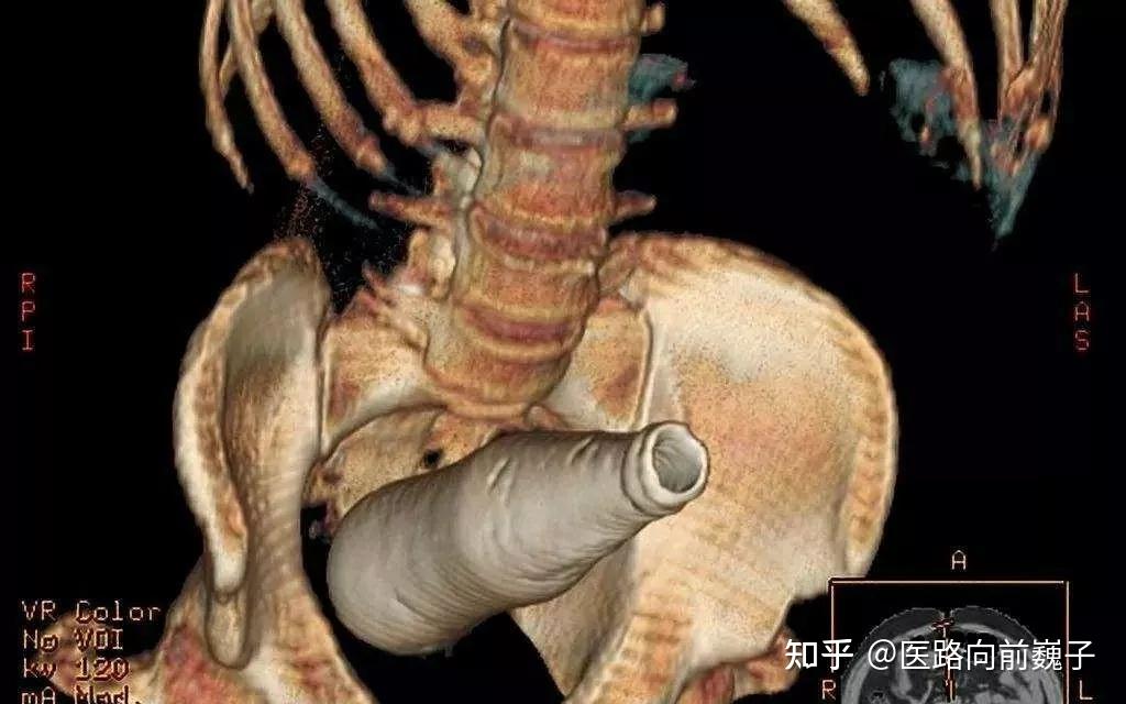 zhuanlan.zhihu.com