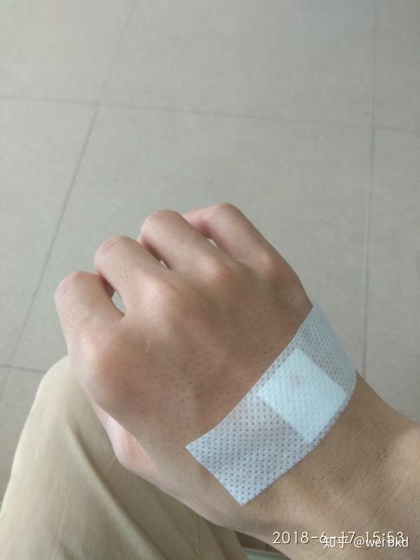 扎得疼,输液的时候手浮肿,原来是没扎到血管,坑啊.