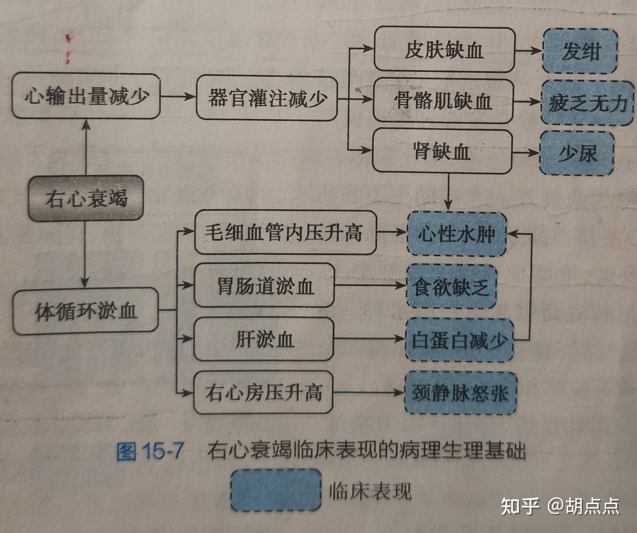 左心衰竭和右心衰竭的临床表现发生机制及区别