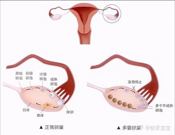 哪些因素会导致卵泡长不大