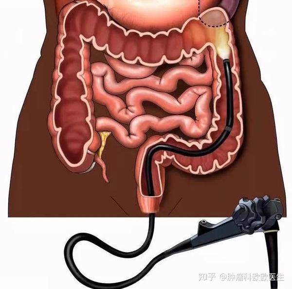 肠镜见到结肠息肉,b超报肝囊肿,我该怎么办?