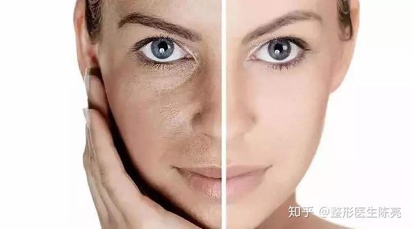 皮肤暗沉?脸部松弛?双下巴?整形医生的这些建议能让你有效抗衰老!