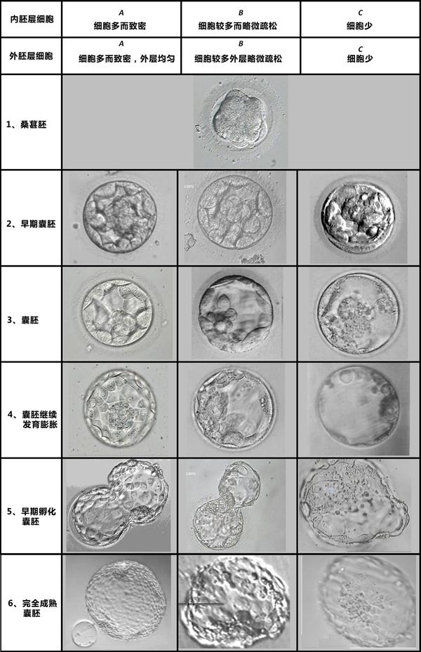 胚胎移植123