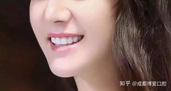 相学:从一个人的牙齿来看他的命运