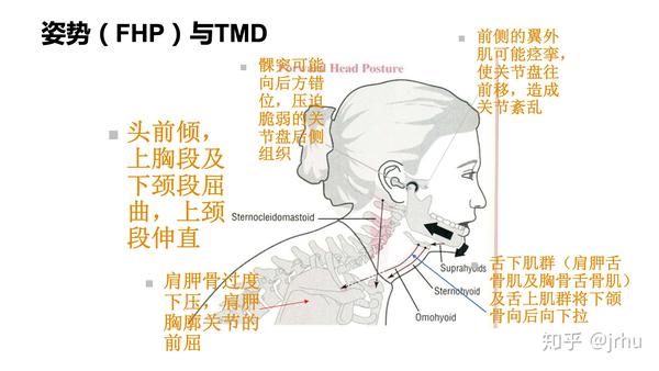 颞下颌关节紊乱(tmd) 与异常呼吸模式