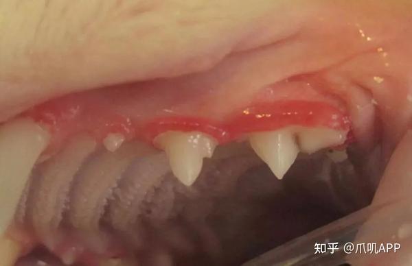 牙龈发炎(图片来源于网络)