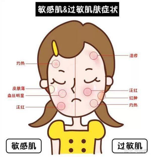一次t区去角质,半个月去全脸 注意事项:混合型肌肤的人夏天容易出油