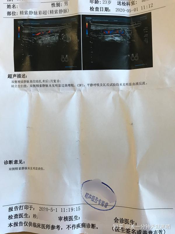 精索静脉曲张手术全记录