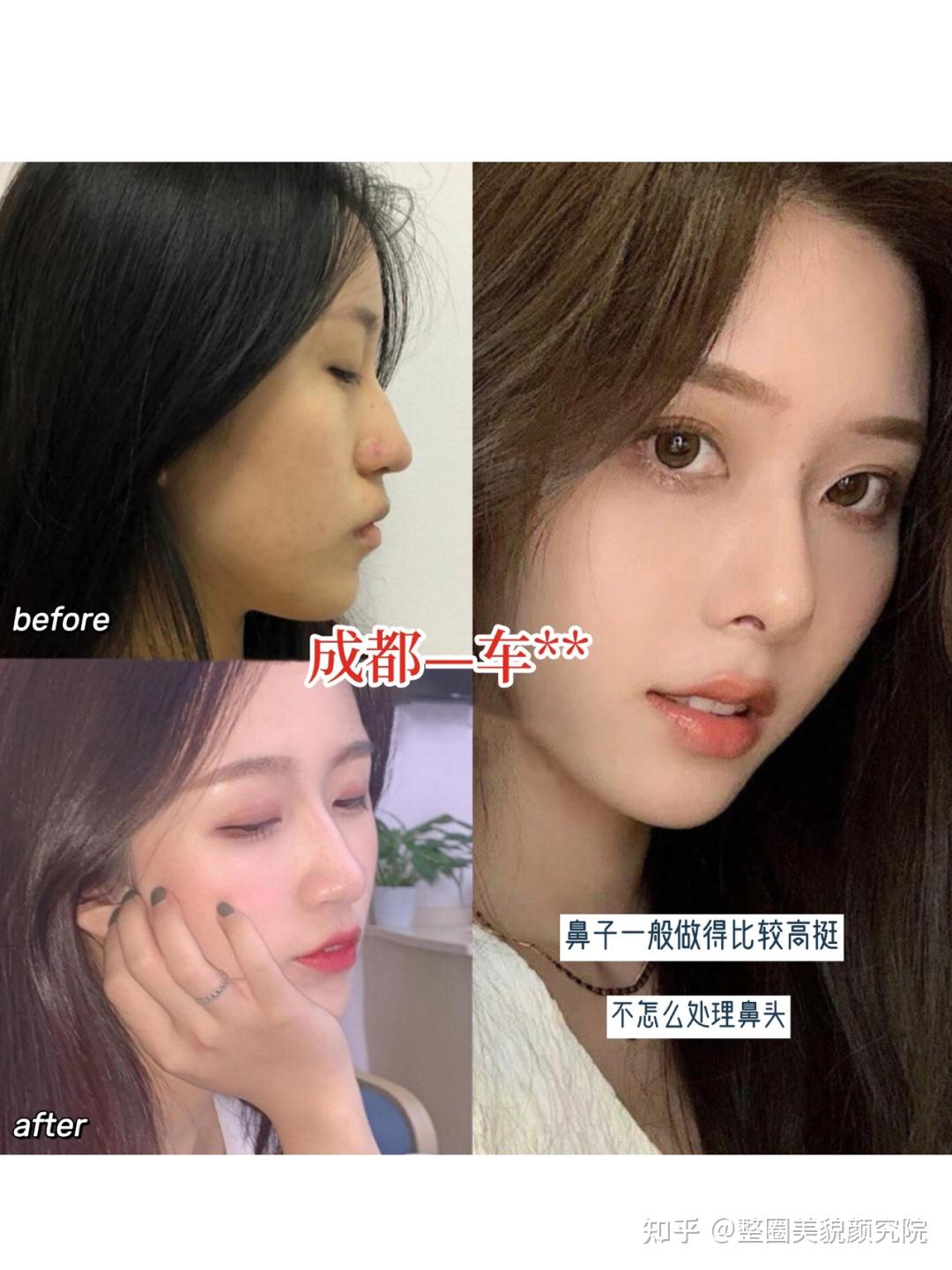 擅长扇形;鼻子也有在做,鼻子一般做得比较高挺,喜欢自然风的集美就