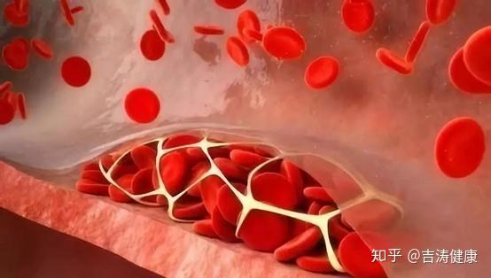 泽罗发现它们在血管损伤后的止血过程中起着重要作用,首次提出血小板