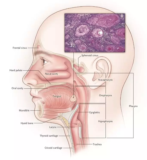 头颈部鳞状细胞癌的主要解剖部位